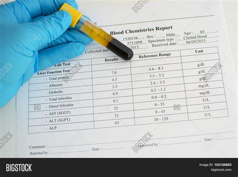 normal liver blood test results